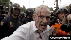 Uno de los heridos en la carga policial ocurrida esta tarde en la plaza de Neptuno cuando varios jóvenes de la protesta del 25S intentaron traspasar la valla que protege el acceso al Congreso de los Diputados.