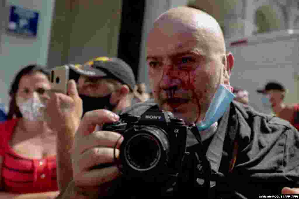 El fot&#243;grafo de AP, el espa&#241;ol Ram&#243;n Espinosa, aparece con heridas en la cara mientras cubr&#237;a una manifestaci&#243;n contra el presidente cubano Miguel D&#237;az-Canel en La Habana, el 11 de julio de 2021. .